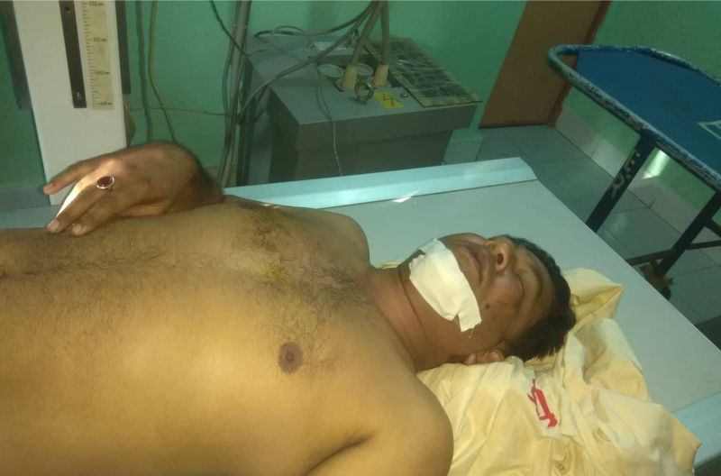 আহত সাংবাদিক কামরুল ঢাকা স্কয়ার হাসপাতালের আইসিও’তে
