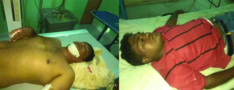 ভোলায় সড়ক দুর্ঘটনায় সাংবাদিক কামরুল ও লক্ষন গুরুতর আহত