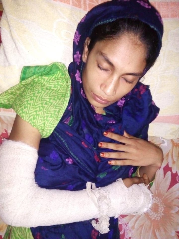চরফ্যাশনে যৌতুকের দায়ে স্ত্রীর হাত ভেঙ্গে দিয়েছে পাষন্ড স্বামী