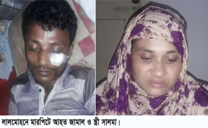 লালমোহনে সালিশে শাস্তি হওয়ায় বাদীকে পিটিয়ে আহত