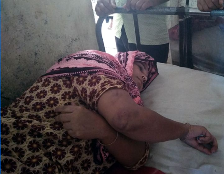 তজুমদ্দিনে পরকীয়ার প্রতিবাদ করায় স্ত্রীর উপর হামলা