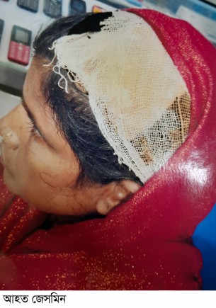 লালমোহনে জমির বিরোধ নিয়ে অন্তসত্তা গৃহবধুকে কুপিয়ে জখম