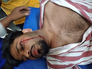 চরফ্যাশনে গাছ কাটা নিয়ে যুবককে মারধর