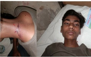 লালমোহনে অবৈধ বিদ্যুত সংযোগ বিচ্ছিন্ন করাকে কেন্দ্র করে হামলায় আহত-৩