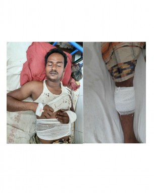 চরফ্যাশনে ইউপি নির্বাচনকে কেন্দ্র করে হত্যা চেষ্টার অভিযোগ