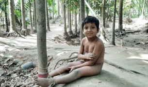 ভোলায় দড়িতে বাঁধা শিশু কাওছারের জীবন!