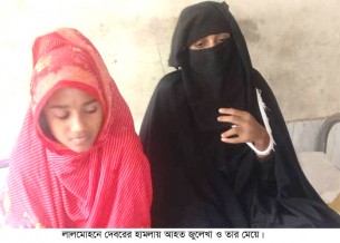 লালমোহনে দেবর পিটিয়ে ভেঙে  দিলো ভাবির হাতের তিন আঙুল