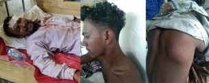 লালমোহনে যুবকসহ পরিবারের ৫জনকে হাতুড়ি ও রড দিয়ে পিটিয়ে জখম
