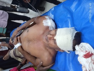 চরফ্যাসনে ব্যবসায়ীকে কুপিয়ে হত্যাচেষ্টা, গ্রেফতার-১