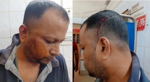 ভোলায় সন্ত্রাসী হামলায় গুরুতর আহত রুবেলকে উন্নত চিকিৎসার জন্য ঢাকায় প্রেরণ