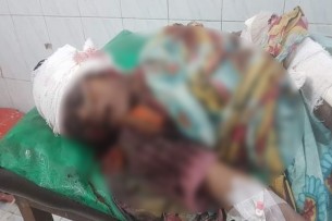 লালমোহনে ট্রলির চাপায় বৃদ্ধা নিহত, আহত-১