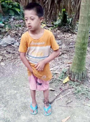 তজুমদ্দিনে প্রতিবন্ধী শিশুকে শিকলে বেঁধে মানসিক ও শারীরিক নির্যাতনের অভিযোগ