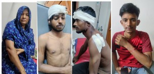 তজুমদ্দিনে প্রবাসী পরিবারের কাছে টাকার দাবীতে হামলা। ছুরিকাঘাতে ৪জন আহত
