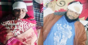 দৌলতখানে জমি বিরোধের জেরে প্রতিপক্ষের হামলায় আহত- ২