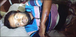 তজুমদ্দিনে মহিষের বাছুরের ঘাস খাওয়াকে কেন্দ্র করে মারামারি