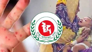 হাম উপসর্গে আরও ৮ মৃত্যু, প্রাণহানি ছাড়াল ৯০০