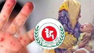 হাম উপসর্গে আরও ৮ জনের মৃত্যু