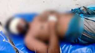 মাই‌ক্রোবা‌সে তুলে নিয়ে যুবকের দুই চোখ উপড়ে ফেলার অভিযোগ, গ্রেপ্তার-১